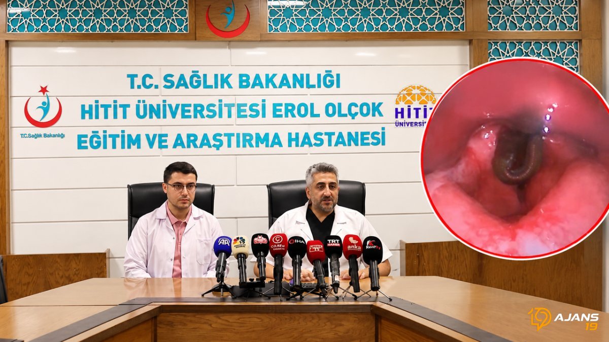 Boğazından Çıkarılan Sülük Hayatını Kararttı: Öğretmenin Ağızdan Çıkan Kanlı Hikayesi!
