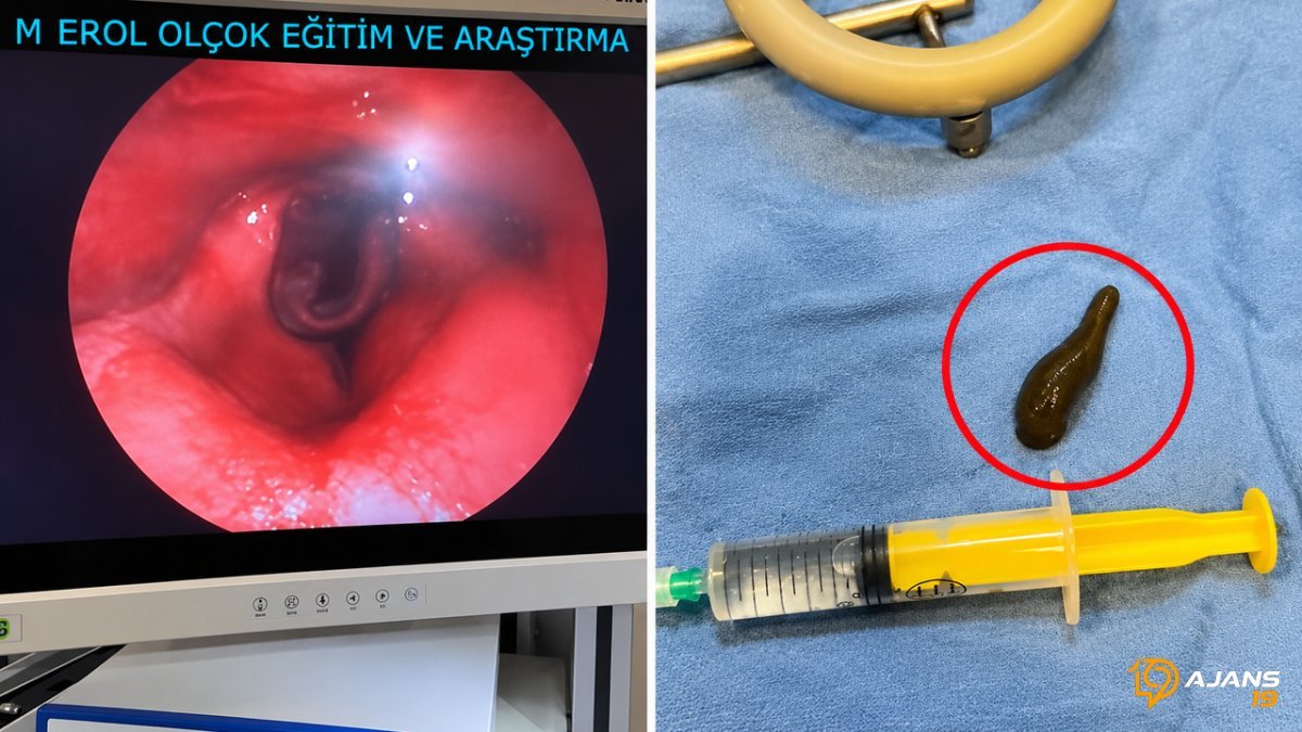 Boğazından Çıkan Canlı Varlık Nefesleri Kesti! Doktorlar Şoke Oldu: Hayat Pazarlığı 24 Saat Sürdü