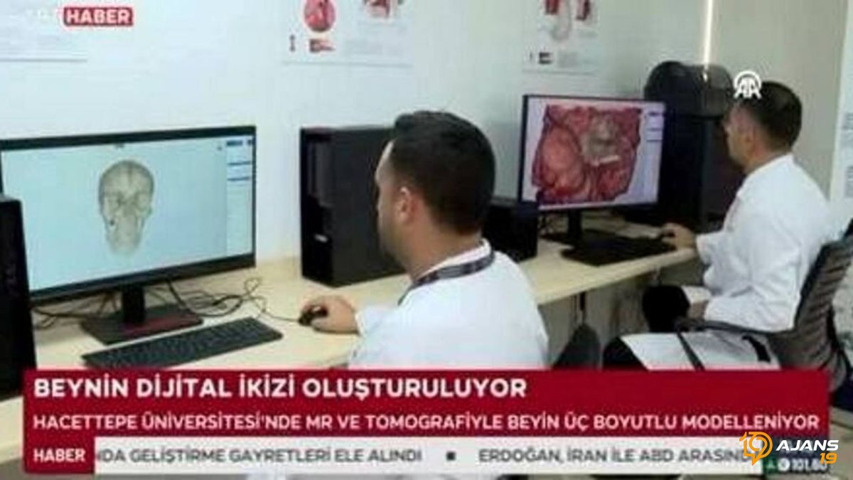 Hacettepe'den Tıpta Devrim Niteliğinde Yerli Teknoloji: Ameliyatlar Artık Çok Daha Güvenli ve Hızlı!