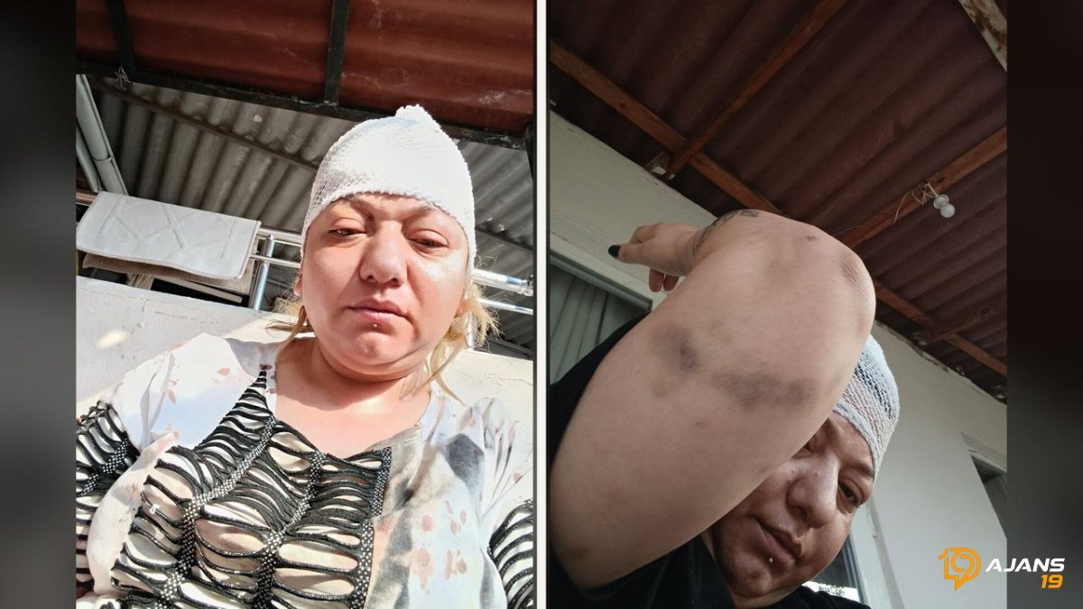 Öldü Sandılar, Ormana Attılar! Akrabasının Düğününde Hayatı Karardı: Gözaltına Alınan Şüpheli Tutuklandı